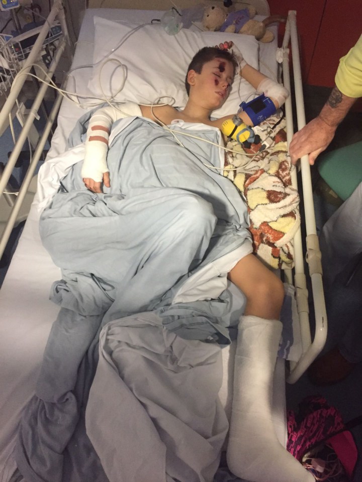  Jake Jones suffered serious injuries when he was hit by a motorbike while walking home from school