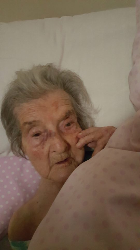 The 98-year-old has now claimed she was bruised by care workers 