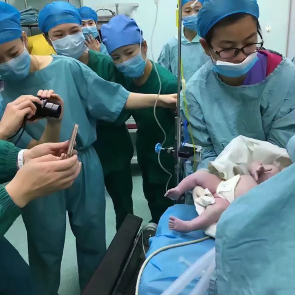  The woman's baby girl was delivered by C-section, after experts managed to get her mum ready for surgery