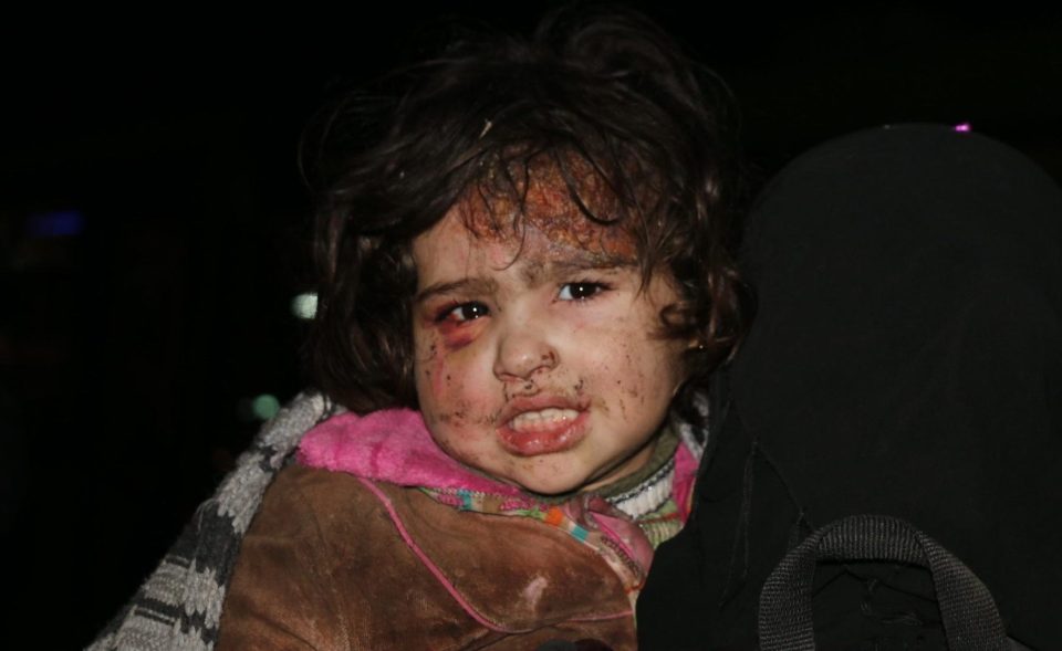 An injured child among the civilians trying to flee from East Aleppo