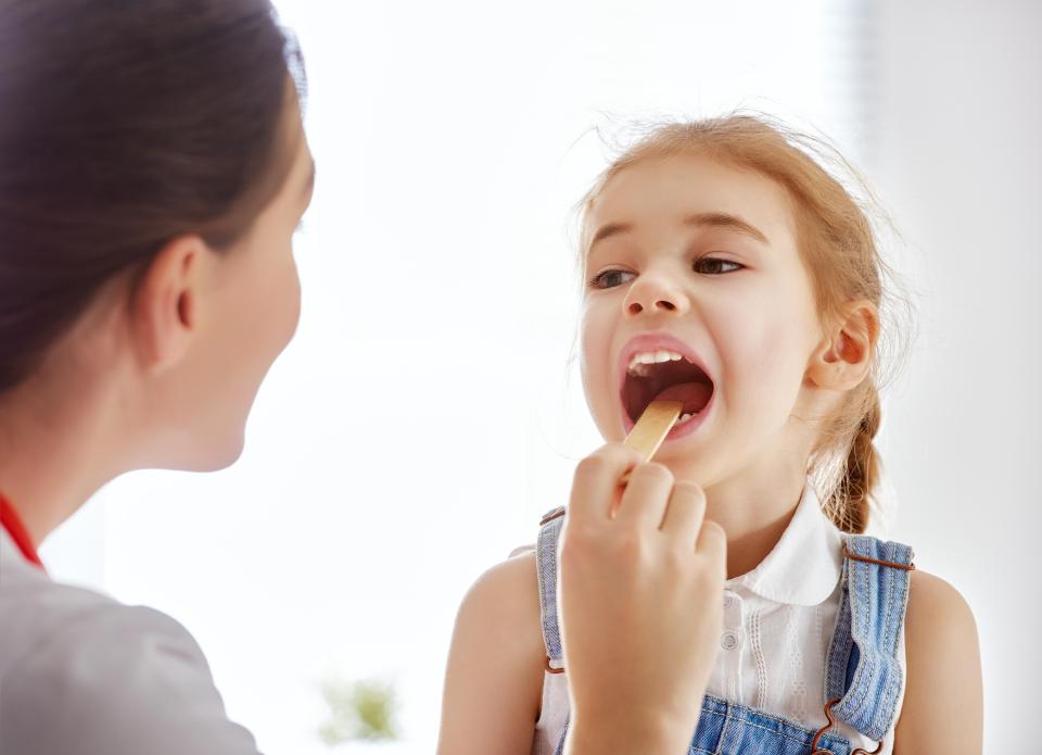  One of the main symptoms of tonsillitis is a sore throat, with evidence of white spots on the tonsils