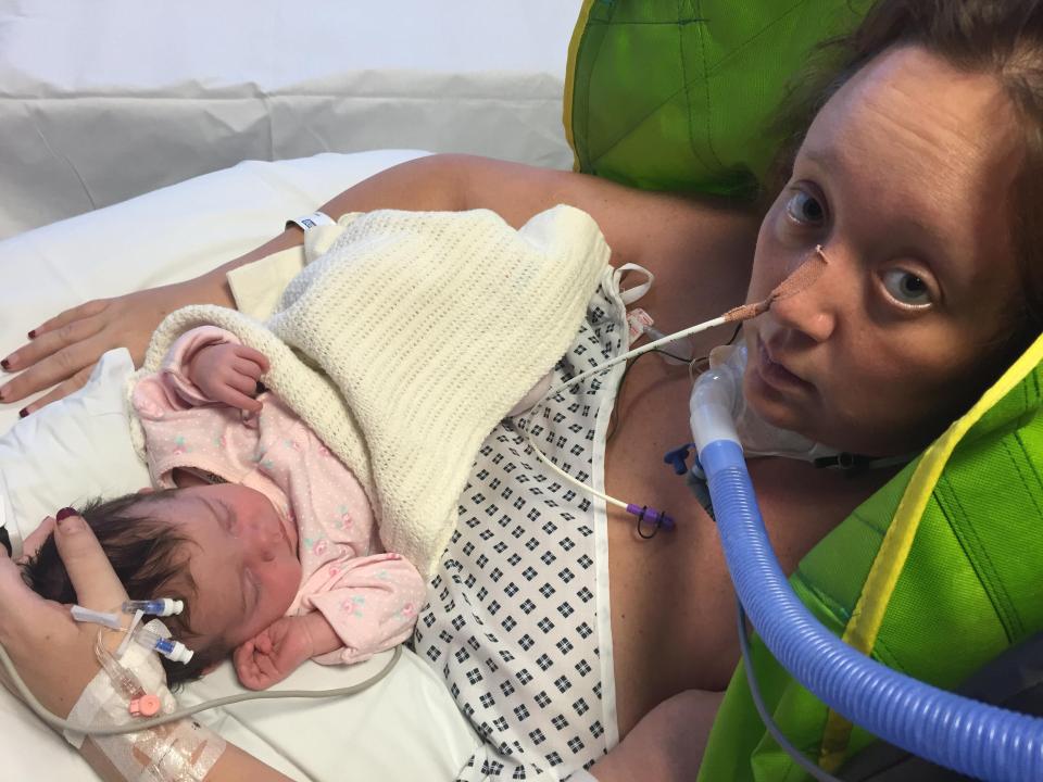  Nicola was briefly allowed to hold her baby before she was put in an induced coma