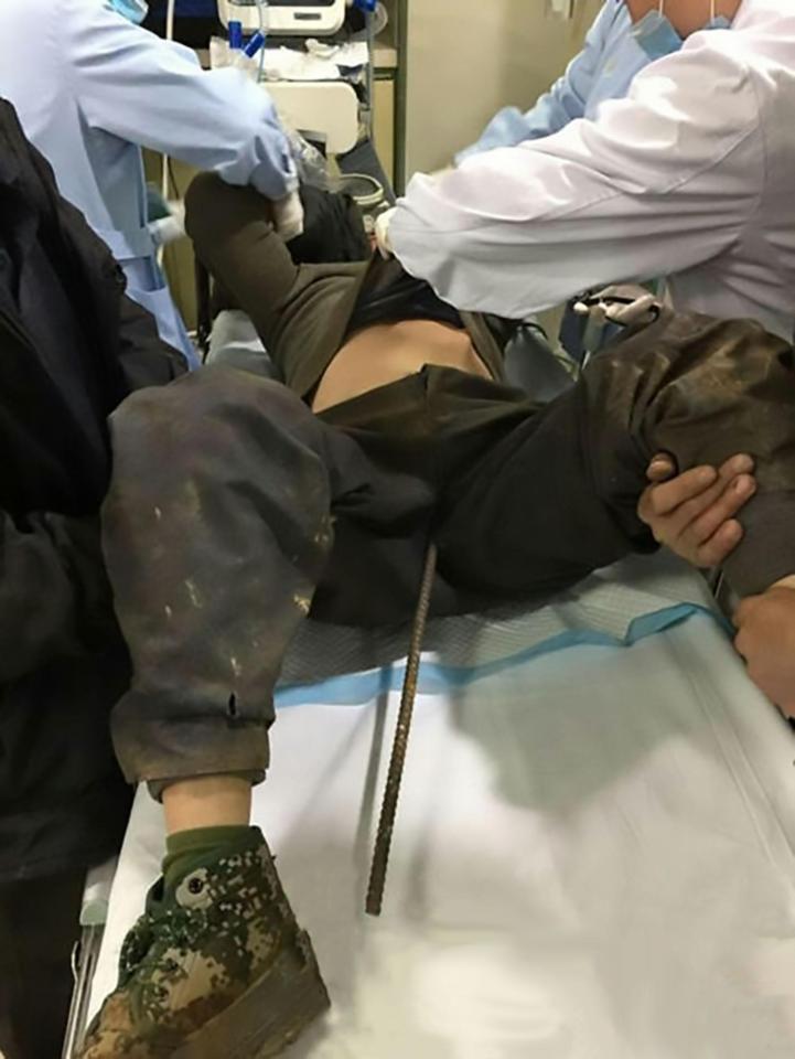  A construction worker was rushed into surgery when a metal bar impaled his crotch