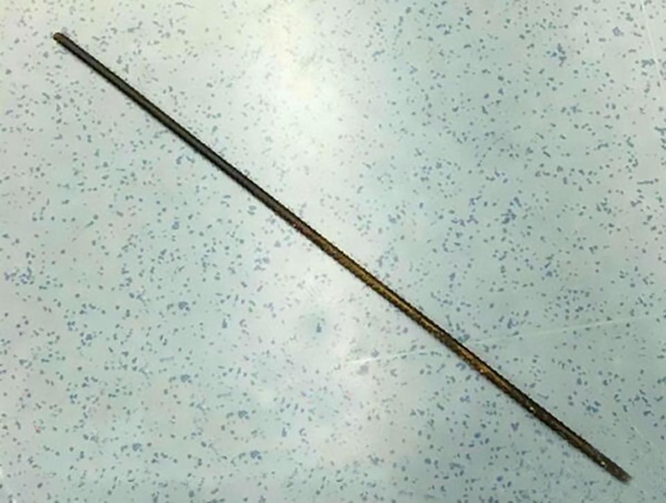  The 23-inch bar after being removed from the man by doctors with the help of firefighters