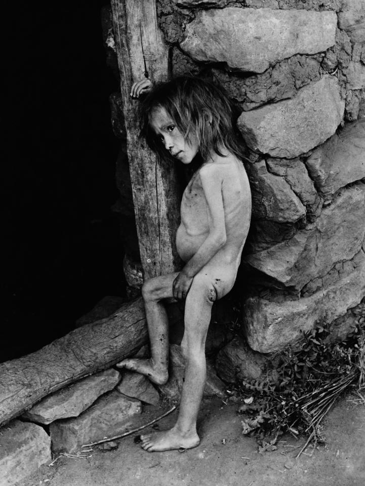  A starving little girl stands naked against a wall in 1921 at the height of the famine