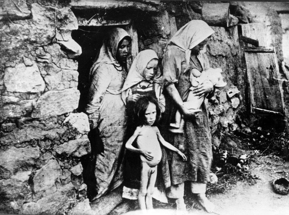  A family suffering from severe hunger poses for the camera