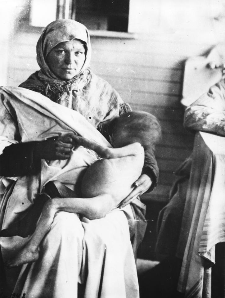  A child dying of hunger in the Volga region