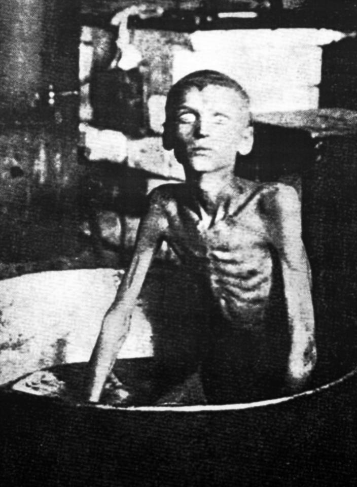  An emaciated boy pictured in 1933 during the Ukrainian famine