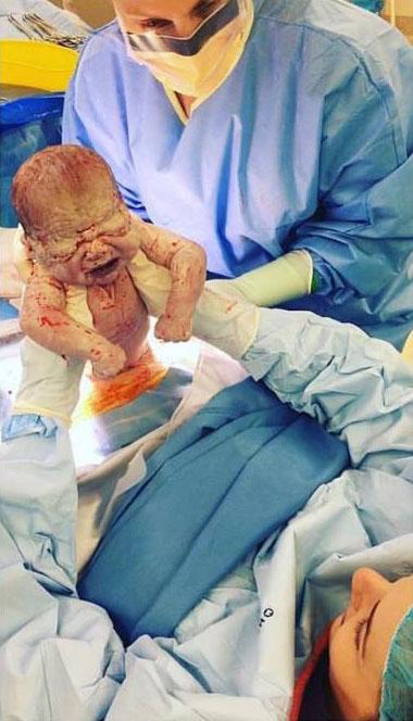  Sarah Toyer said lifting her own baby out of her womb during her C-section was the 'most incredible' thing she had ever done