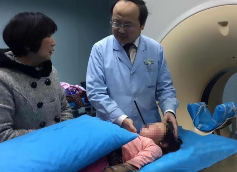  A little girl's skull was impaled by a chopstick after a freak accident in China