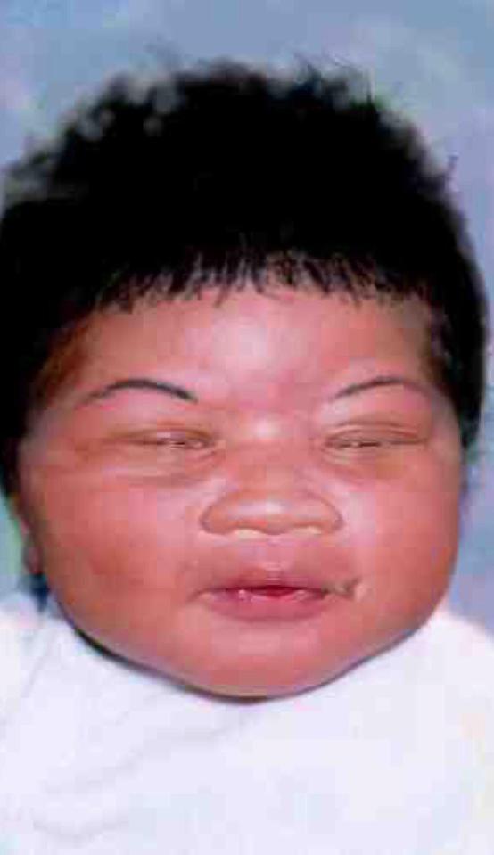  Baby Kamiyah Mobley, raised as Alexis Manigo, pictured before she was taken from a Florida hospital in 1998