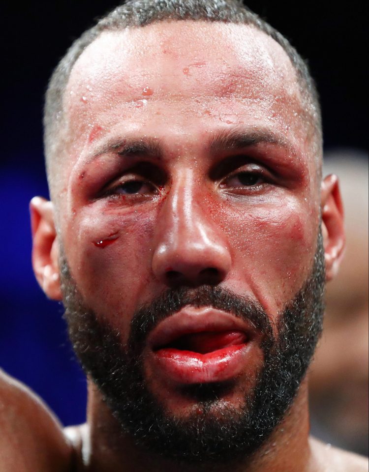  DeGale said he had been looking forward to a gritty fight in the trenches