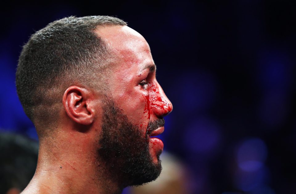  The fighter took his own barber to America did not look pretty after 12 rounds