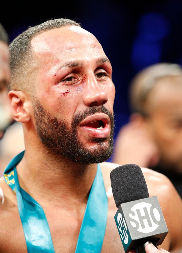  This was the first real battle DeGale had been in since he lost to George Groves