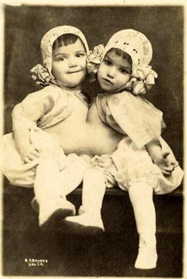  Guadalupe and Josephine Hinojosa known as The Cuban Twins, circa 1914