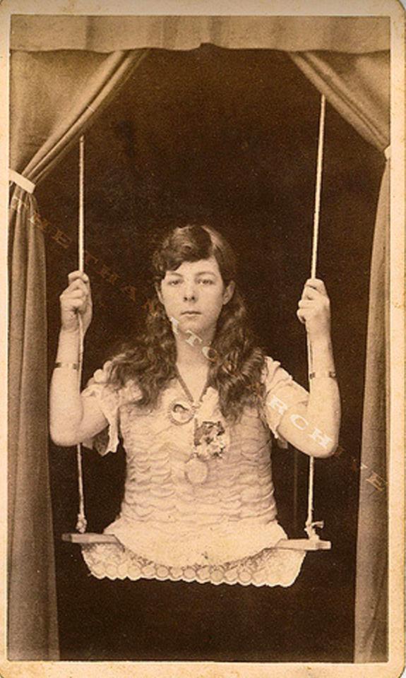  This postcard from 1885 shows a girl with no legs on a swing