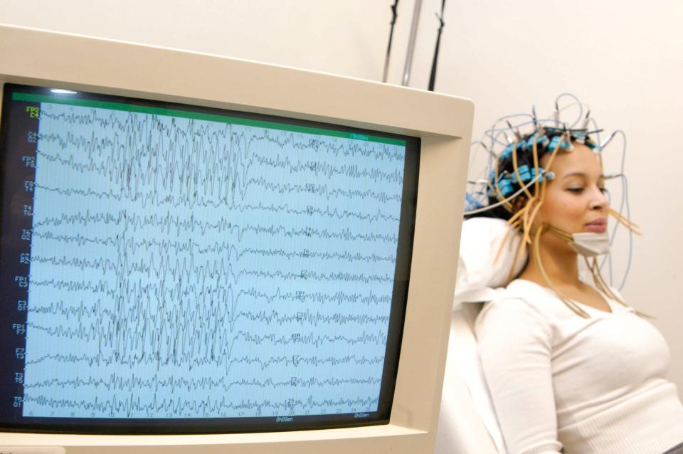  One in 100 people in the UK are believed to be epileptic