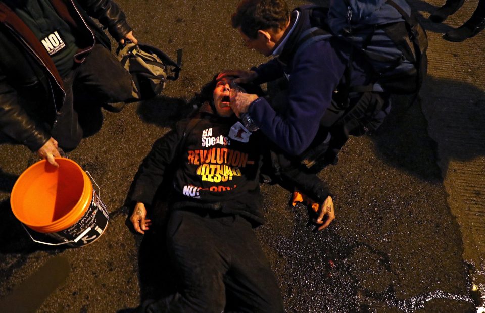  A protester has eyes doused with water after cops used tear gas in  Washington DC