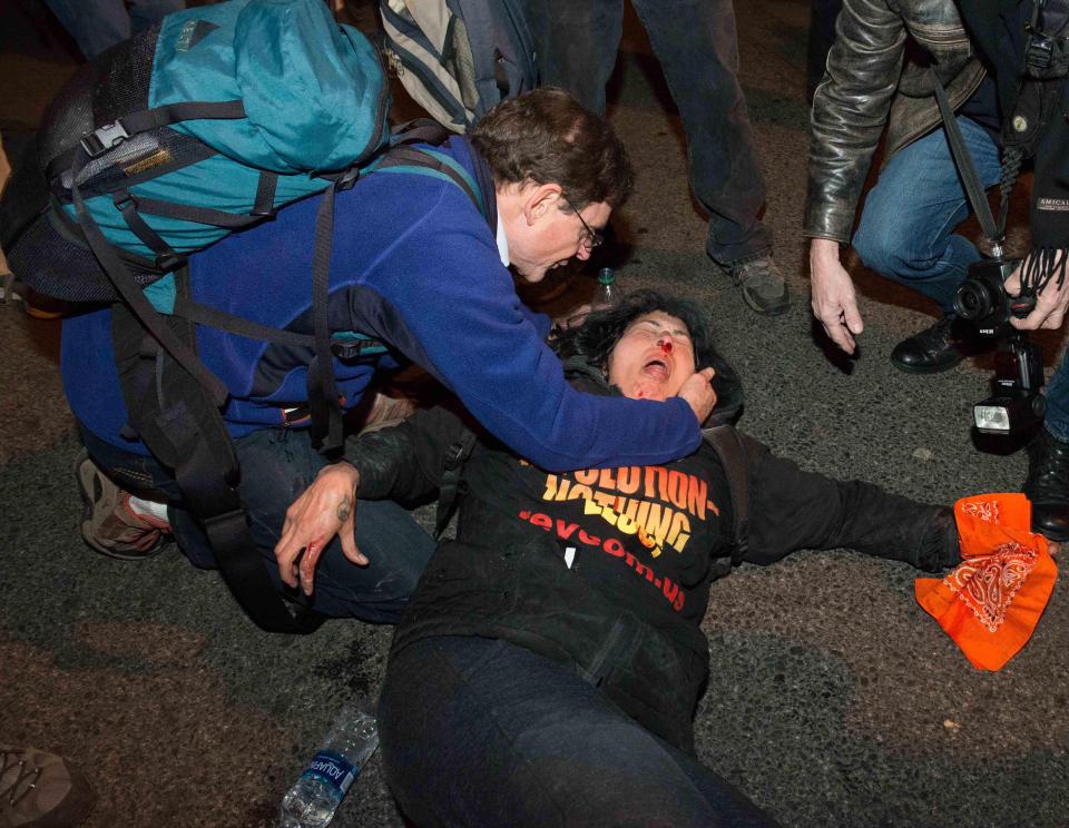  A protester has her eyes doused with water after allegedly being pepper sprayed by police outside of the Deplora Ball at the National Press Building