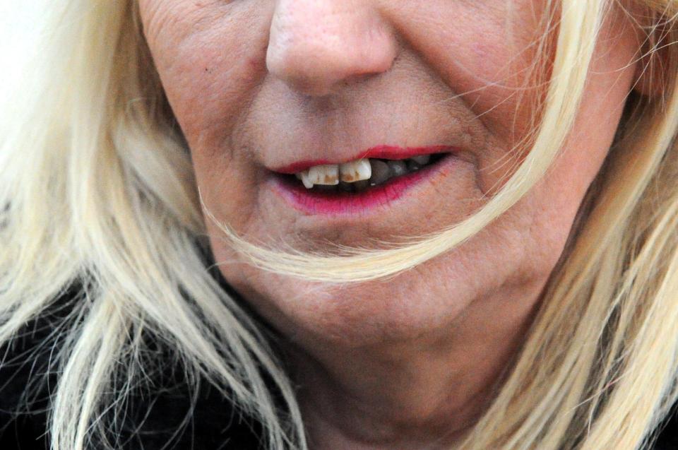  The transgender cabbie has previously appeared on the Jeremy Kyle Show and Judge Rinder and says her teeth have been destroyed by hormones and violence