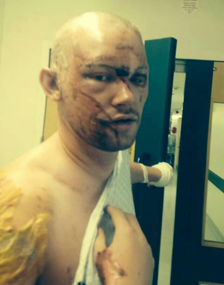  Dad-of-two Mr Pidgeon, 29, spent 24 days in hospital following the attack