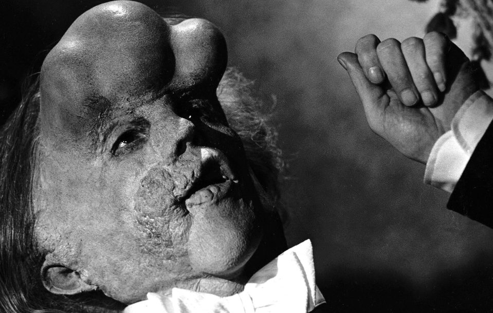  One of John's most prominent films was The Elephant Man