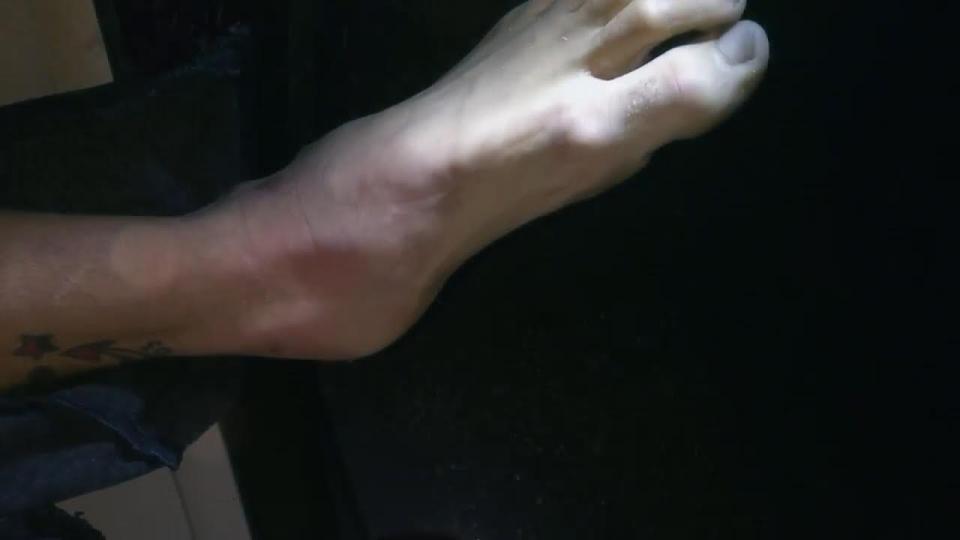  The bruised and battered foot of 8Booth after his latest stunt went wrong and he ended up in hospital