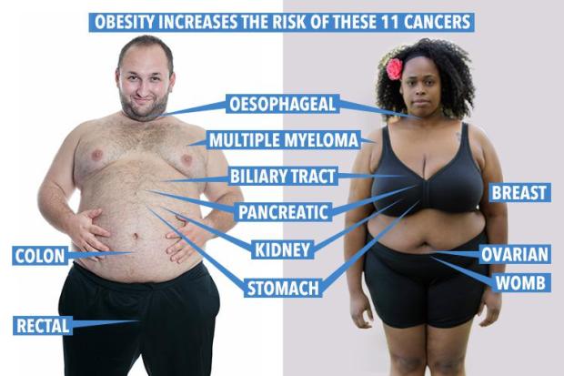 Being obese has been linked to 11 types of cancer, researchers at Imperial College London found