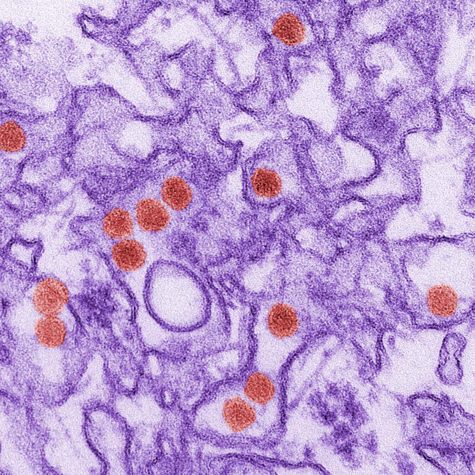  Zika virus can survive for months in human semen