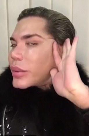  Rodrigo Alves claims he is trolled over his 'too big chin implant'