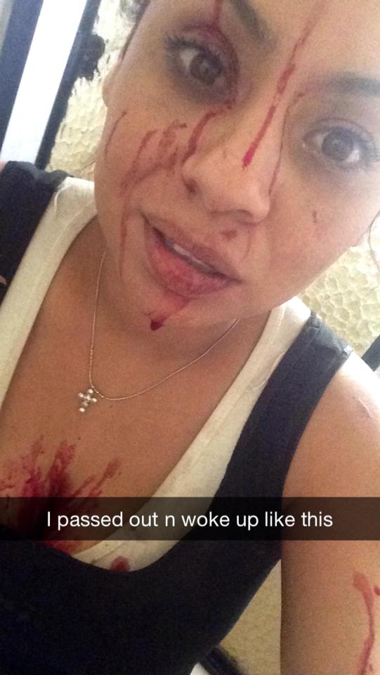  The 34-year-old woke in a pile of blood, but didn't think she'd done any serious damage