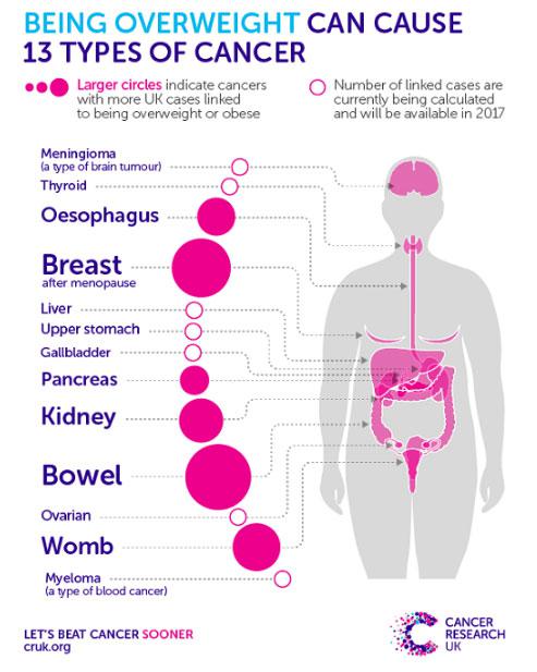  Obesity is linked to 13 different cancers, as fat cells produce hormones known to fuel tumours