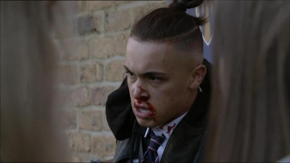  Shakil was left bloodied after the vicious school yard fight