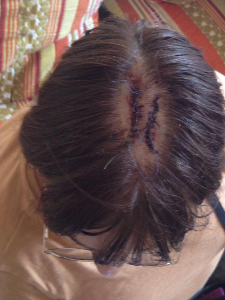 One wedding guest, Ruth Ricketts, was left needing stitches on her head