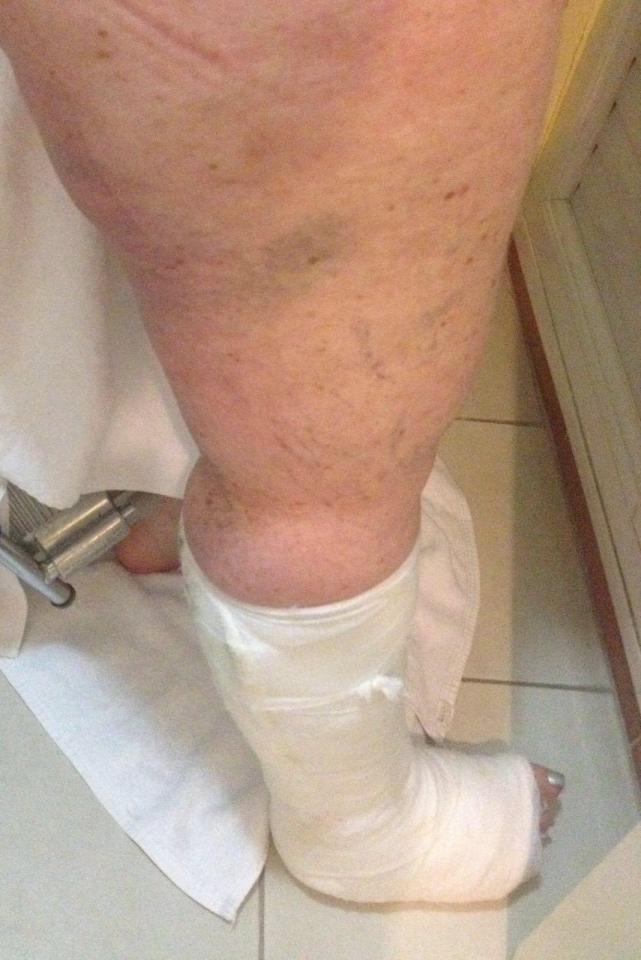 Sharon Broyed, a wedding guest, broke her leg in the incident