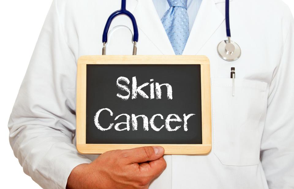  Basal cell carcinoma is one of the most common forms of skin cancer