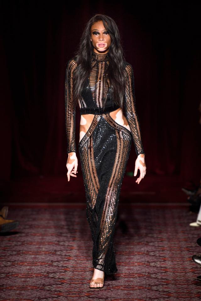  Winnie Harlow stole the show in a racy cut-out dress