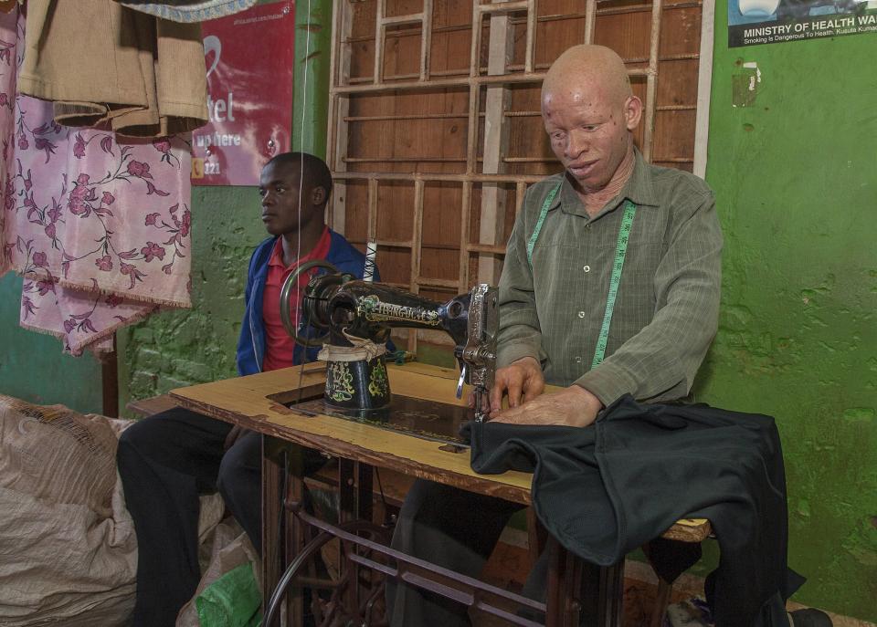  Potions made from albino body parts have been known to sell for as much as £7,000