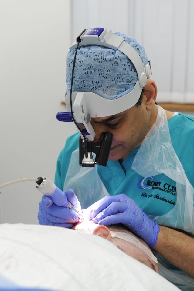 He rebuilt Kanwal's eyebrows and eyelashes by transplanting hair from the back of her scalp