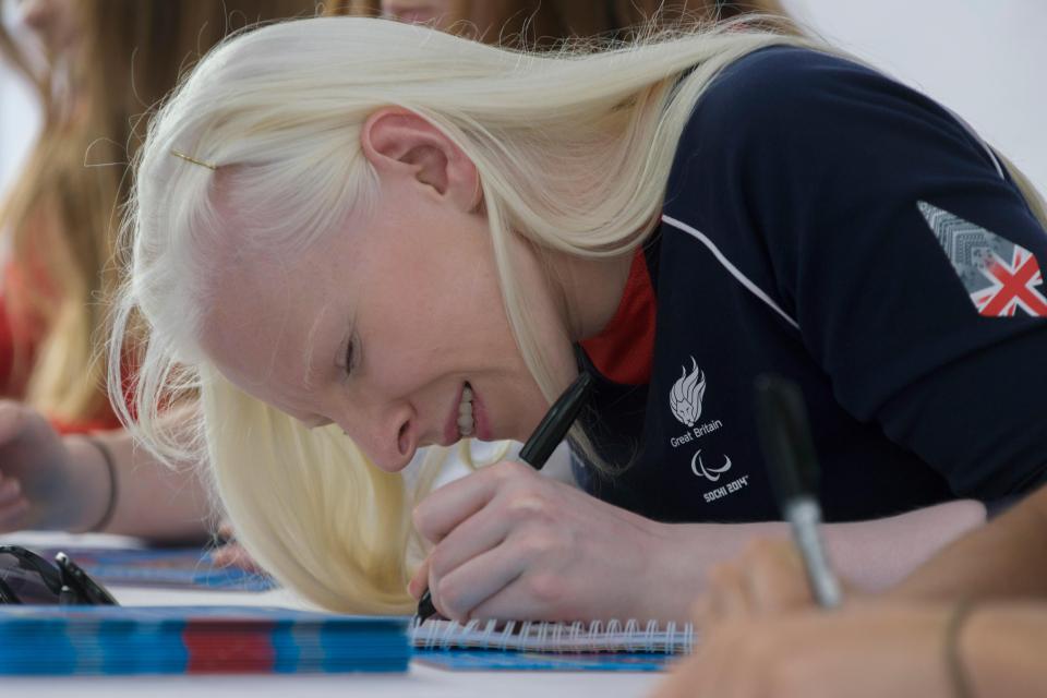  Albinism sufferers usually have very pale skin, pale hair and blue eyes