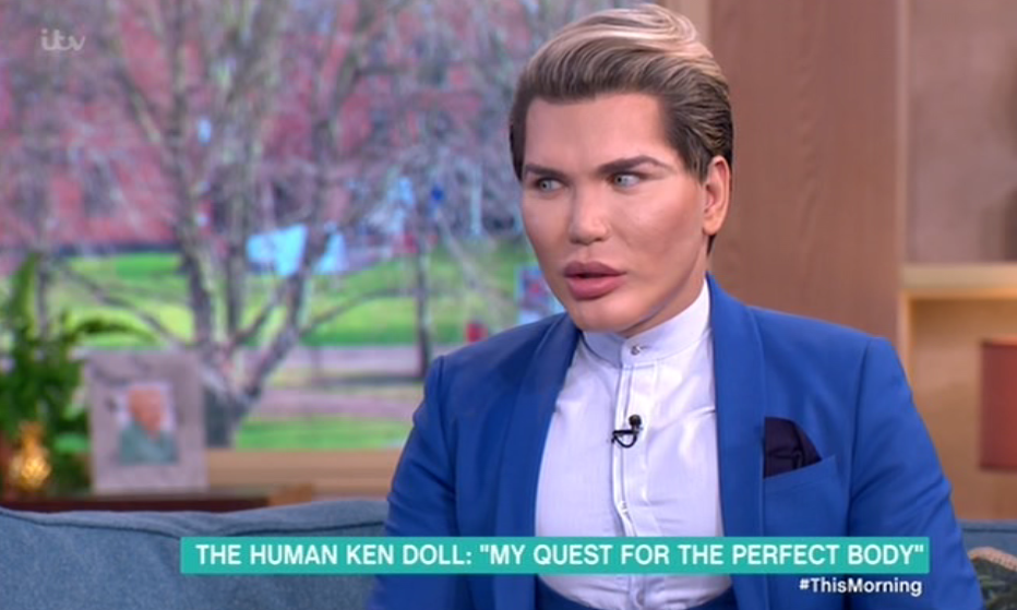  Human Ken Doll Rodrigo Alves will not stop going under the knife, even though he can't breathe properly