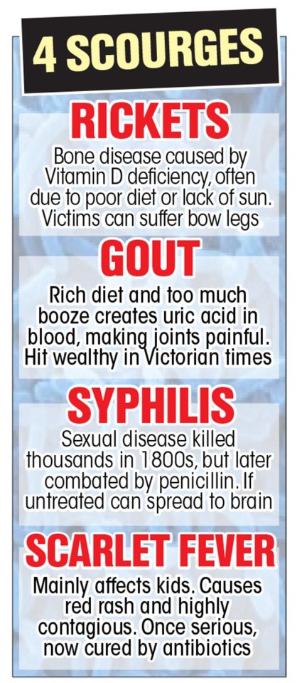 All four diseases are likely to be more prevalent as not all sufferers will have gone to hospital