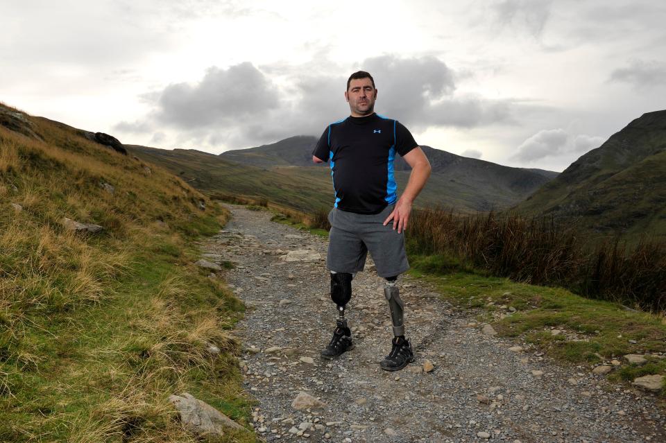  Despite being a triple amputee, Andy Scott has climbed Mount Snowdon