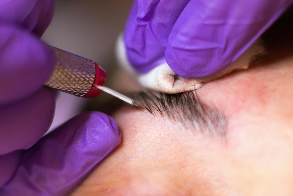  Semi-permanent makeup involves having pigment implanted into the epidermis using a fine needle