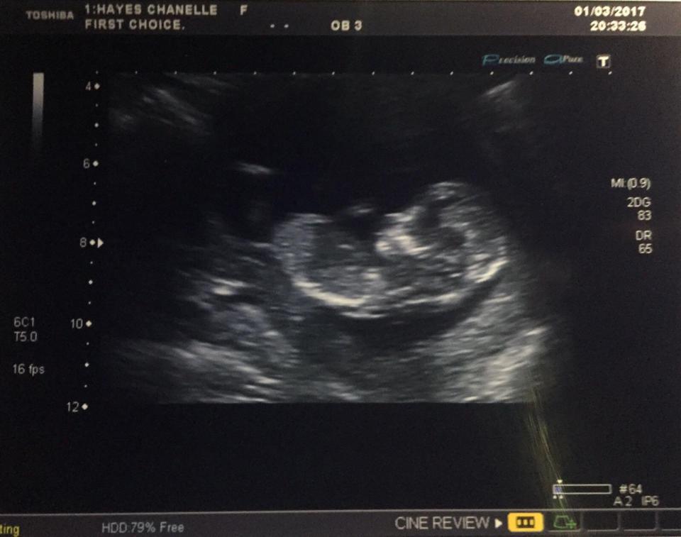  The tiny tot is 13 weeks old and both Chanelle and Ryan are busy planning a gender reveal party