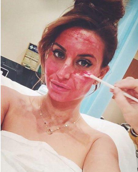  While TOWIE's Ferne McCann was the latest star to get the cosmetic treatment