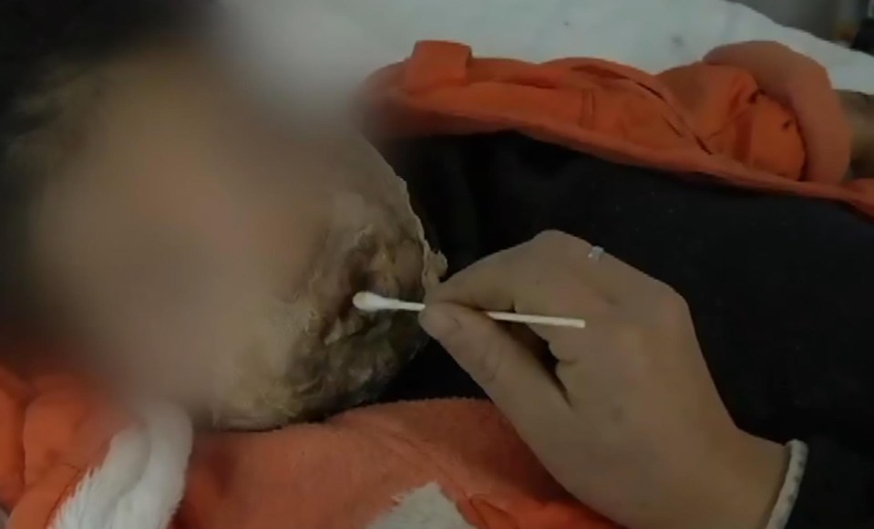 This little girl was burned when a Galaxy Note 4 exploded, according to her dad