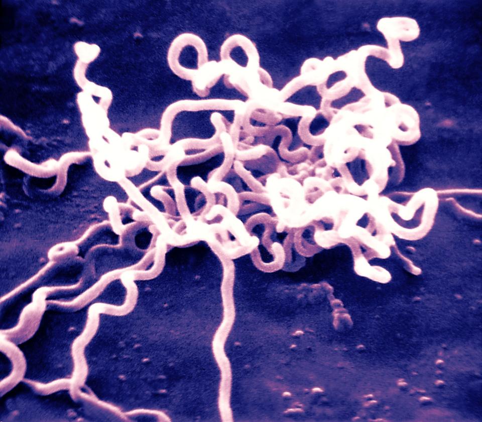  The bacterial infection is often sexually transmitted, but can also be a result of sharing needles