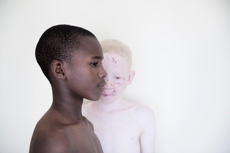  The photographs were taken by Dutch photographer Marinka Masséus