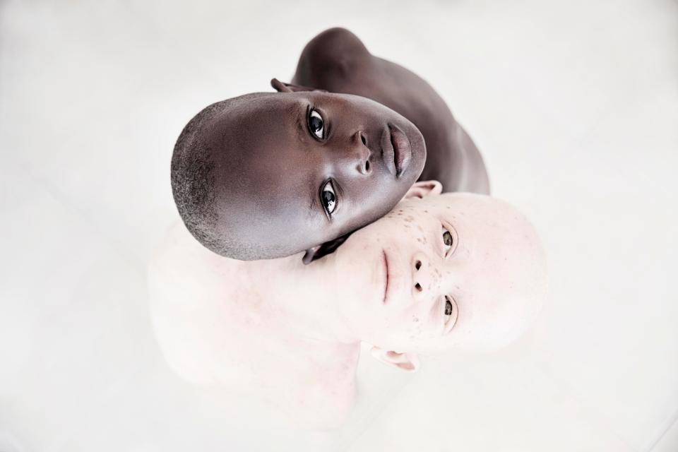  The portraits were taken to raise awareness of the plight of Tanzania's persecuted albino population